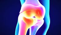 illustration of knee joint